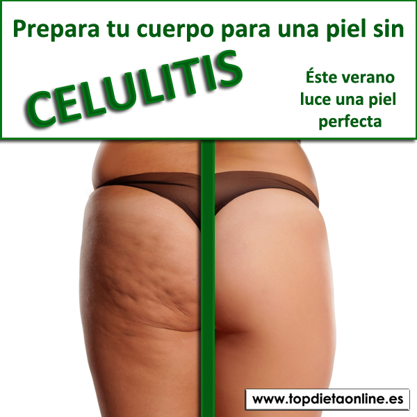 Piel-sin-celulitis-ste-verano-topdietaonline.jpg