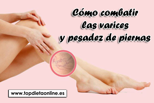 Combatir-las-varices-y-pesadez-de-piernas-topdietaonline.jpg