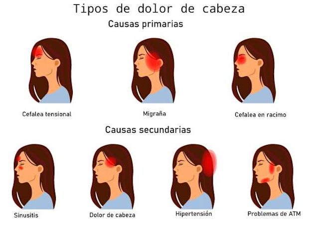 Causas de dolores de cabeza